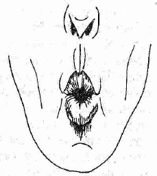 hromatica_odin_noty